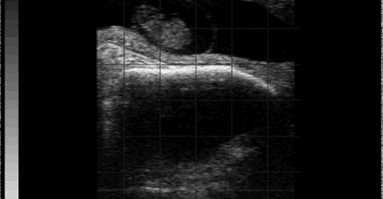Easi-scan 3 Bovine 36 Days Pregnancy
