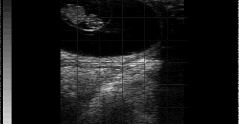 Easi-scan 3 Bovine 38 Day Pregnancy
