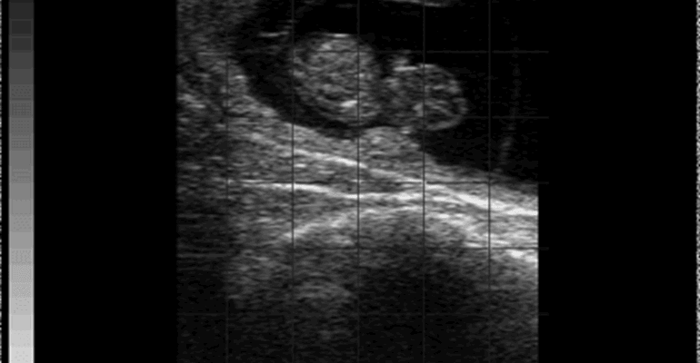 Easi-scan 3 Bovine 45 Day Pregnancy