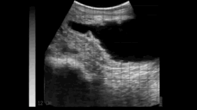 Fetus normal bovine bull calf BCF Easi-Scan
