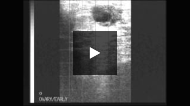 Bovine Ultrasound: Ultrasound Clip from a Pregnant Cow (Video 8/9)