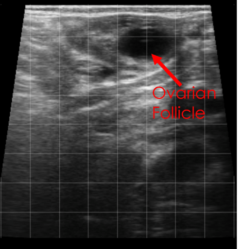 ovarian follicle