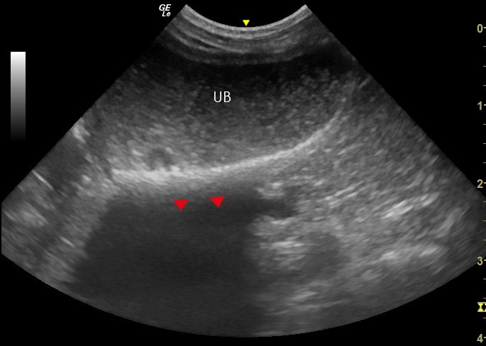 Ultrasonography of the Urinary Bladder - bladder sediment