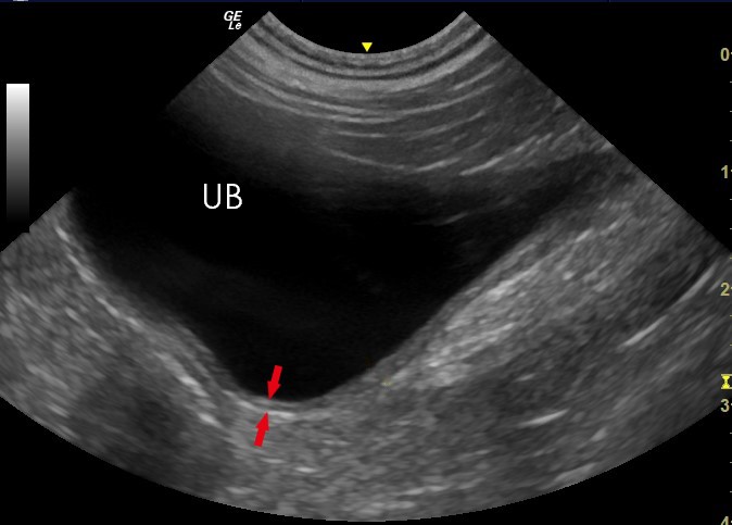 Ultrasonography of the Urinary Bladder - bladder wall