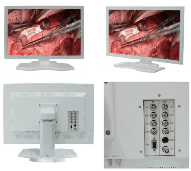 Medical Grade Monitor IMV Imaging
