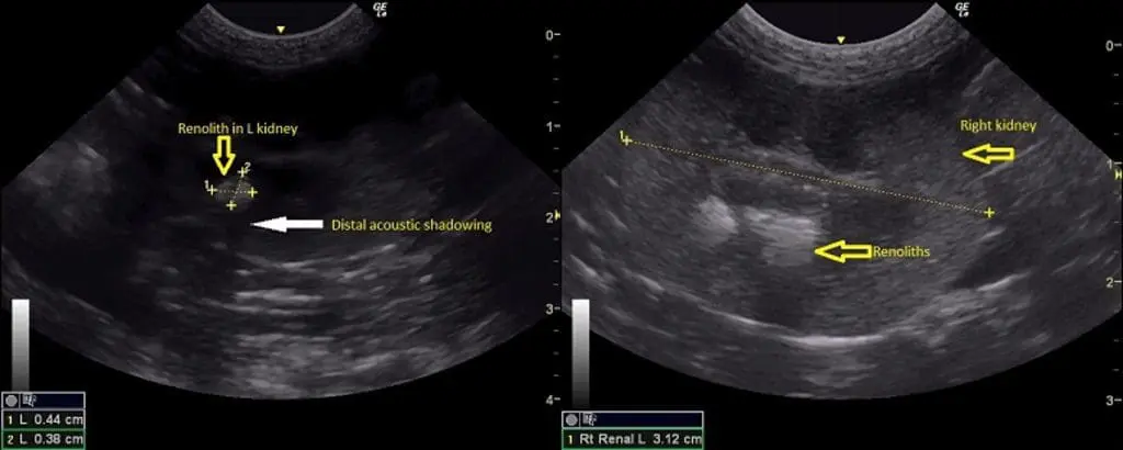 Ultrasound images of the left kidney (left) and right kidney (right)
