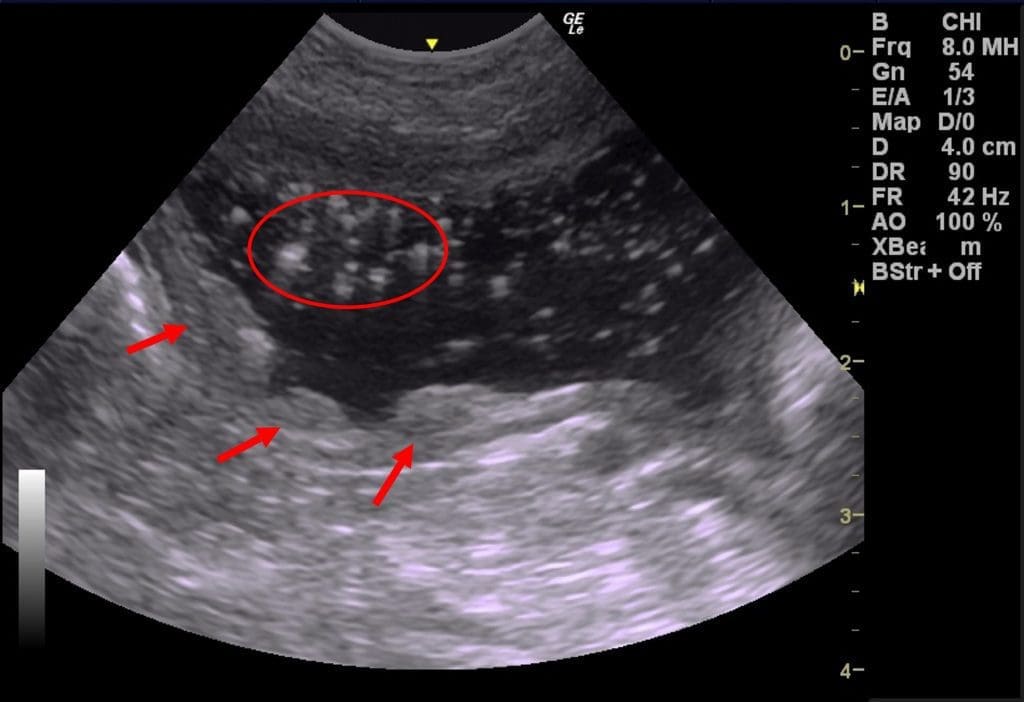 In this sagittal plane image of the bladder
