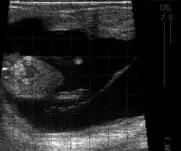 Bovine Fetus – approx 71 days. 