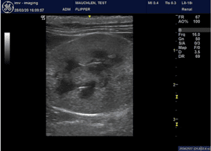 Feline left kidney using a linear hockey stick probe