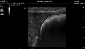 Long axis view of canine liver with wide band linear probe